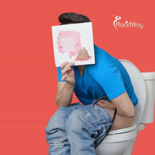 Colorectal Cancer in Mexico: How Immune Therapies and Alternative Options Are Changing Lives